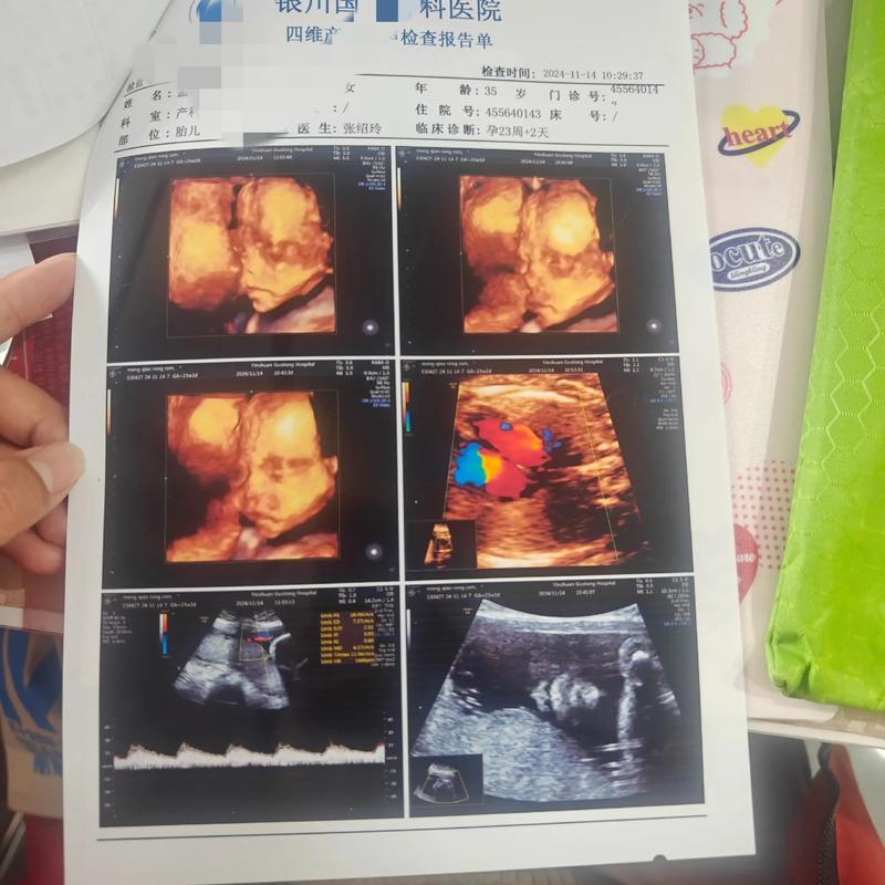 寻找安全可靠的妇科治疗：什邡女子医院值得信赖吗？