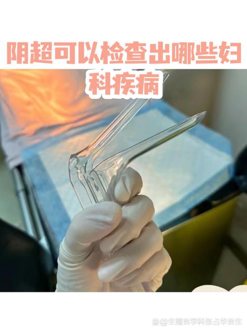 妇科检查:女性健康的守护者