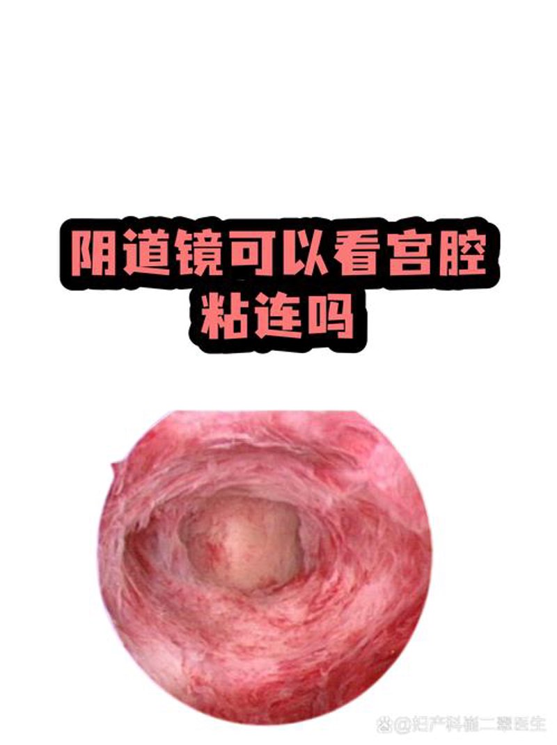 内分泌失调